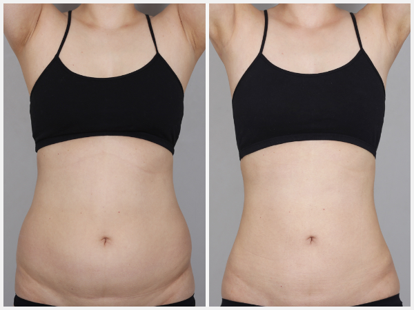 Before & After Image - body